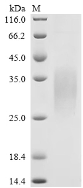 Recombinant Mouse Glucagon-like peptide 1 receptor (Glp1r), partial (Active) (CSB-MP009514MO1)