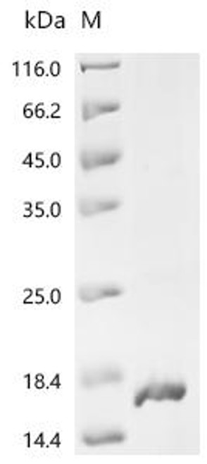 Recombinant Human papillomavirus type 16 Truncated L2 protein (L2), partial (CSB-EP6382HML)