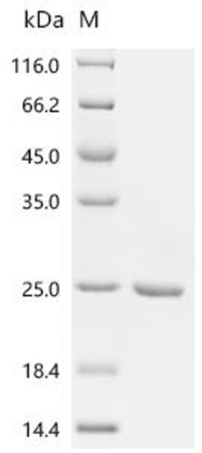 Recombinant Staphylococcus aureus Large ribosomal subunit protein bL12 (rplL) (CSB-EP402772SUJ)