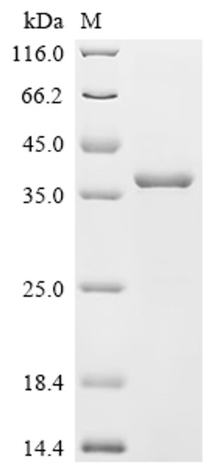 Recombinant Mouse Monoglyceride lipase (Mgll) (CSB-EP013787MO)