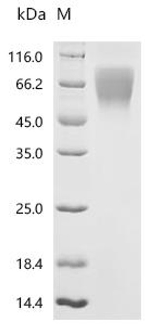 Recombinant Rat Ly6/PLAUR domain-containing protein 3 (Lypd3) (Active) (CSB-MP013263RA)