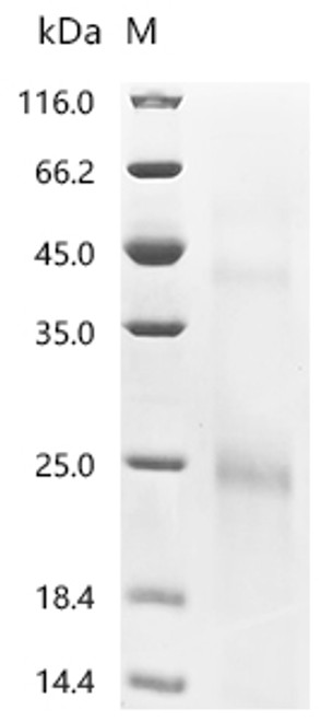 Recombinant Rat Ly6/PLAUR domain-containing protein 3 (Lypd3) (CSB-YP013263RA)