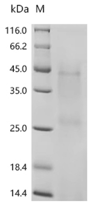 Recombinant Human Ly6/PLAUR domain-containing protein 3 (LYPD3) (CSB-YP013263HU)