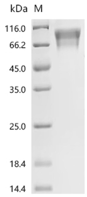 Recombinant Bovine Coagulation factor IX (F9) (CSB-MP007936BO(A4))