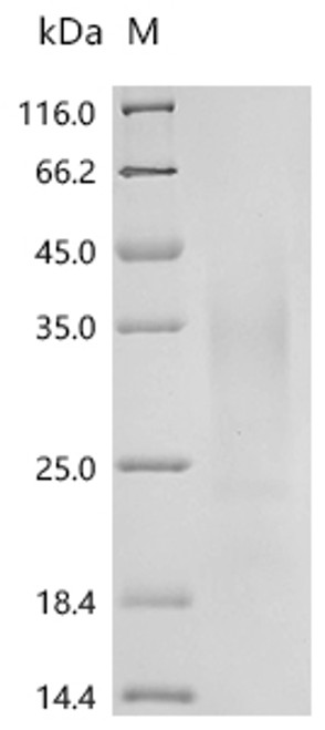 Recombinant Human Interferon gamma (IFNG) (CSB-YP011050HU1)