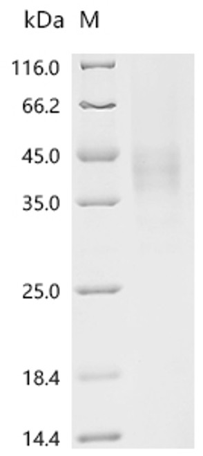 Recombinant Mouse Macrophage colony-stimulating factor 1 (Csf1), partial (CSB-YP006043MOd7)
