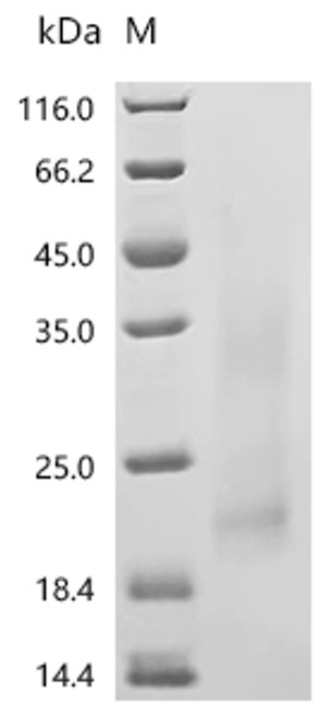 Recombinant Human Interleukin-3 (IL3) (Active) (CSB-YP011652HUd7)