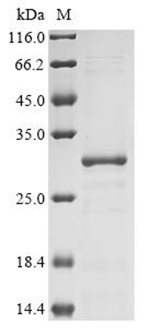 Recombinant Coxiella burnetii Chaperonin GroEL (groEL), partial (CSB-EP323108DXP)