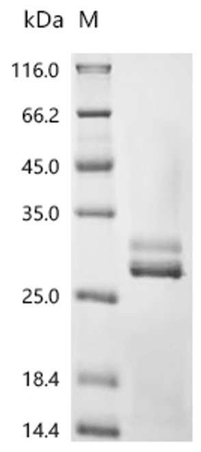 Recombinant Human Kallikrein-2 (KLK2) (CSB-YP012453HU)