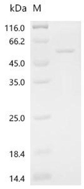 Recombinant Human Actin-related protein 3 (ACTR3) (CSB-EP001249HU)