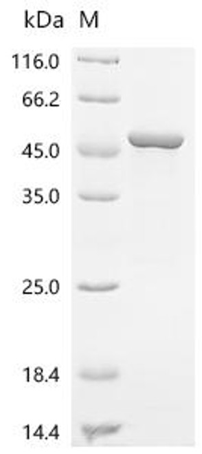 Recombinant Human Actin-related protein 2 (ACTR2) (CSB-EP001248HU)
