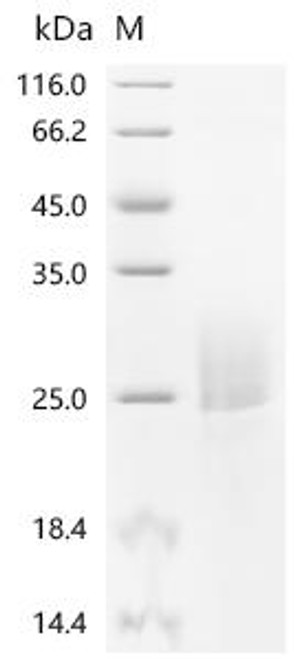 Recombinant Corylus avellana Major pollen allergen Cor a 1 isoforms 5, 6, 11 and 16 (CSB-MP600490CBAD)
