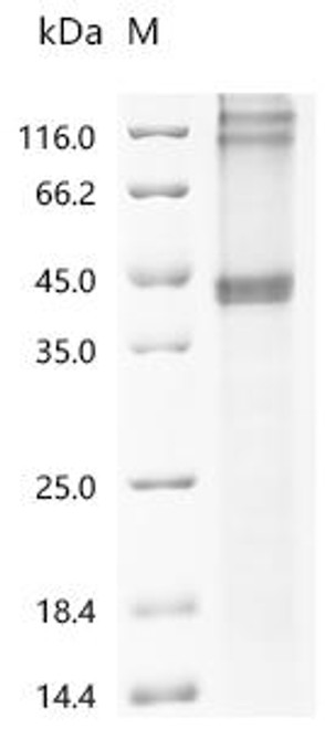 Recombinant Human Corticotropin-releasing factor receptor 2 (CRHR2) (CSB-CF623797HU)
