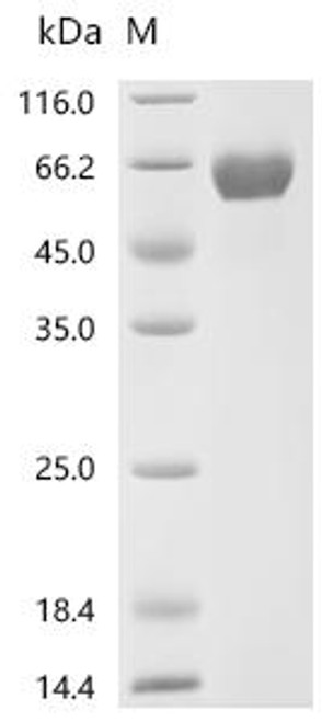 Recombinant Human/Cynomolgus Activin receptor type-2B (ACVR2B), partial (CSB-MP623829HUi9)