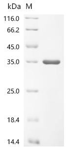 Recombinant Cat Junctional adhesion molecule A (F11R), partial (CSB-EP648931CA)