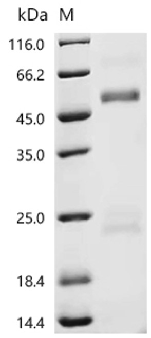 Recombinant Rat Coagulation factor X (F10) (CSB-MP007915RA(A4))
