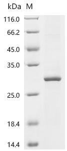 Recombinant Human Probable palmitoyltransferase ZDHHC24 (ZDHHC24) (CSB-CF740919HU)