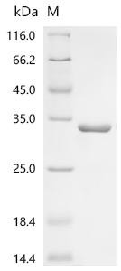 Recombinant Escherichia coli O157:H7 Transcriptional regulatory protein qseB (qseB) (CSB-EP848922EOD)