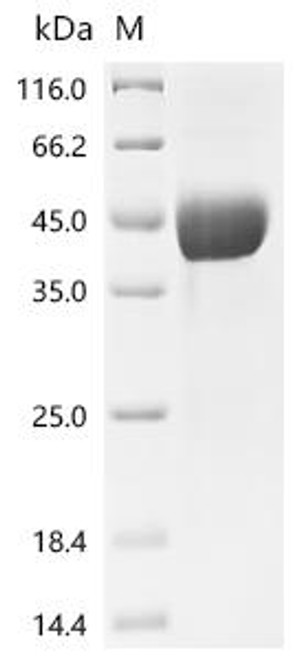 Recombinant Human Platelet glycoprotein VI (GP6), partial (Active) (CSB-MP872550HU)