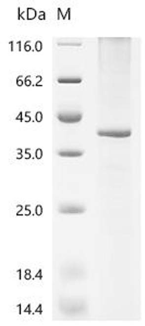 Recombinant Drosophila melanogaster Gustatory receptor for sugar taste 43a (Gr43a) (CSB-CF895567DLU)
