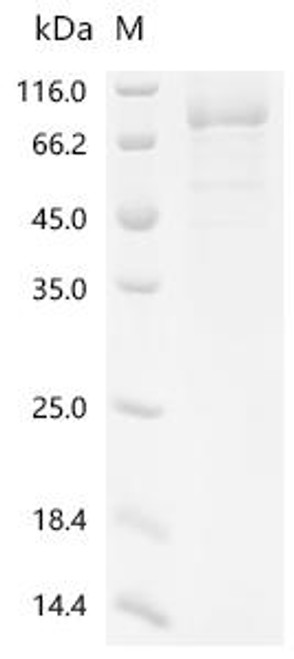 Recombinant Human Fatty acid CoA ligase Acsl3 (ACSL3), partial (CSB-MP001192HU1)