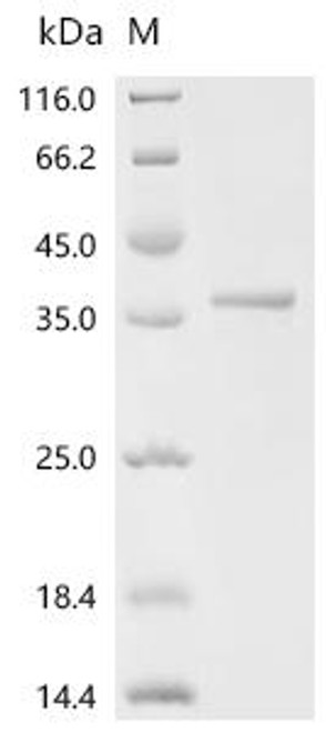 Recombinant Human Immunoglobulin J chain (JCHAIN) (CSB-EP011337HUa2) Recombinant Human Immunoglobulin J chain (JCHAIN) (CSB-EP011337HUa2)