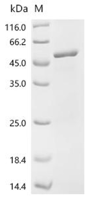 Recombinant Human Ryanodine receptor 1 (RYR1), partial (CSB-EP020619HU1)