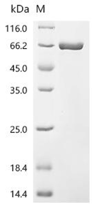 Recombinant BK polyomavirus Small t antigen, Biotinylated (CSB-EP323595BGZ-B)