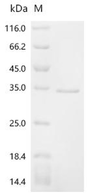 Recombinant Mouse Alpha-actinin-1 (Actn1), partial (CSB-EP766510MO)