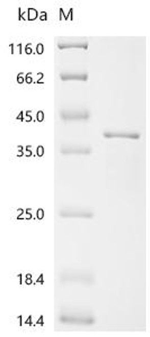 Recombinant Streptococcus agalactiae serotype V Phosphate import ATP-binding protein PstB 2 (pstB2) (CSB-EP350534SMI)