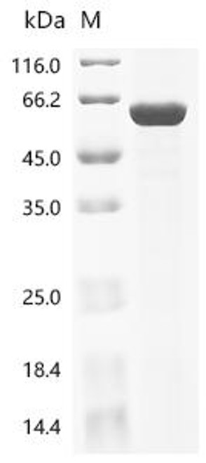 Recombinant Mycobacterium tuberculosis Pup--protein ligase (pafA) (CSB-EP353829MVZ)