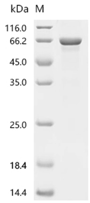 Recombinant Human Prostaglandin G/H synthase 1 (PTGS1) (CSB-EP018985HU)