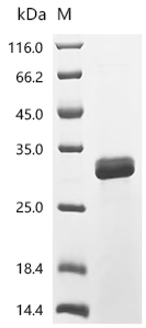 Recombinant Cavia porcellus Lipocalin Cav p 2.0101 (Lcncavp2) (CSB-EP306654GU)