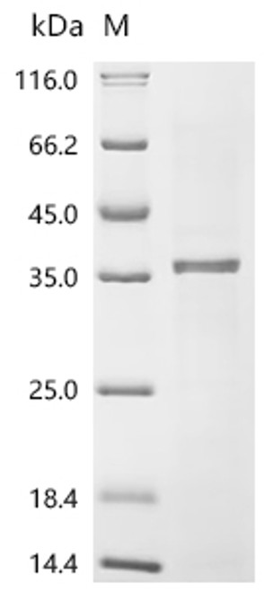 Recombinant Human Kallikrein-2 (KLK2) (CSB-EP012453HUg5)