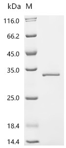 Recombinant Human Transcriptional enhancer factor TEF-5(TEAD3), partial (CSB-EP860344HU1)