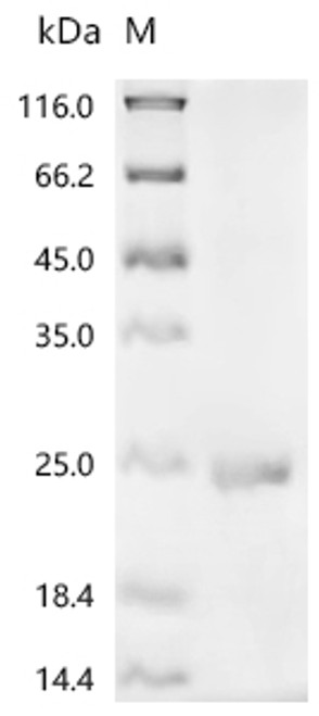 Recombinant Bovine Interleukin-17A (IL17A) (CSB-EP724243BO)