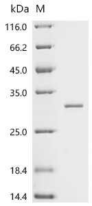 Recombinant Mouse Ferritin heavy chain (Fth1) (CSB-EP009030MO)
