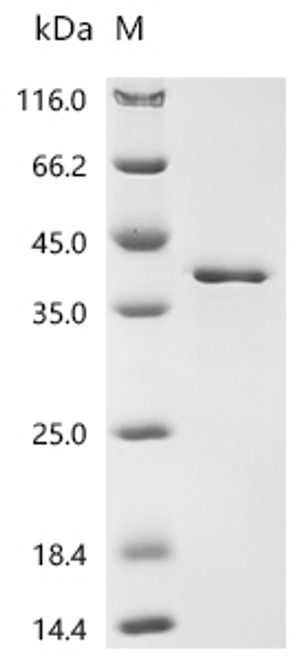 Recombinant Staphylococcus aureus Large ribosomal subunit protein uL2 (rplB) (CSB-EP412679SUI)