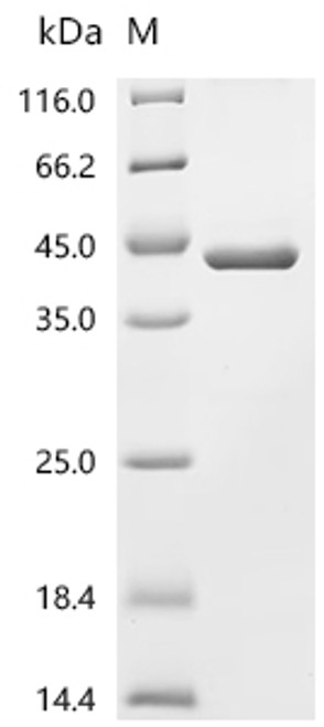 Recombinant Human Myelin protein P0 (MPZ), partial (CSB-EP014774HUc0)