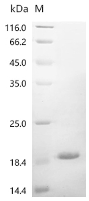 Recombinant Human Gamma-aminobutyric acid receptor-associated protein-like 1 (GABARAPL1) (CSB-EP861986HUc7)