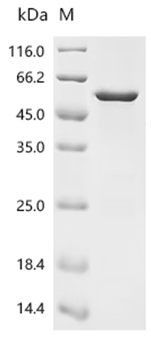 Recombinant Mouse Sprouty-related, EVH1 domain-containing protein 1 (Spred1) (CSB-EP835669MO)