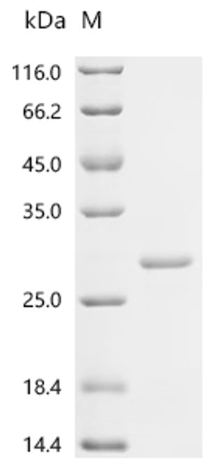 Recombinant Mouse Macrophage colony-stimulating factor 1 (Csf1), partial (CSB-EP006043MO1)