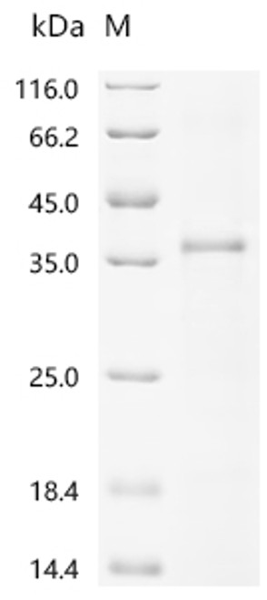 Recombinant Human IgGFc-binding protein (FCGBP), partial (CSB-EP896934HU) Recombinant Human IgGFc-binding protein (FCGBP), partial (CSB-EP896934HU)