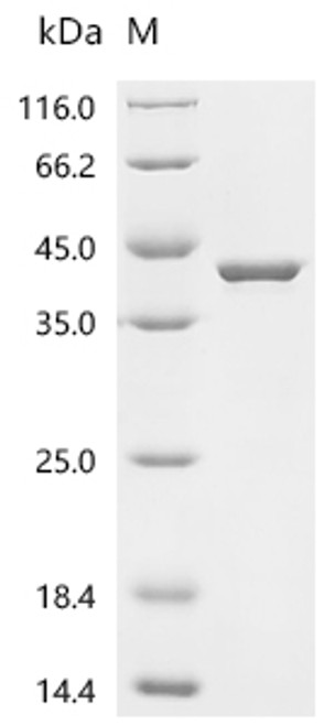 Recombinant Human Synapsin-1 (SYN1), partial (CSB-EP023002HUc7)