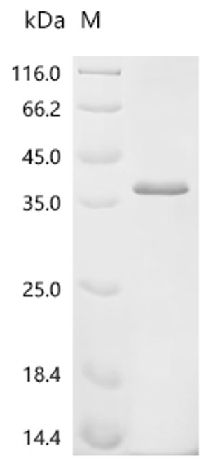 Recombinant Mouse H-2 class II histocompatibility antigen, A-B alpha chain (H2-Aa), partial (CSB-EP320375MO)