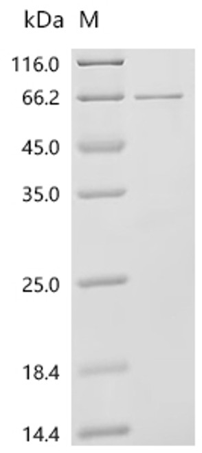 Recombinant Human L-amino-acid oxidase (IL4I1), partial (CSB-EP850426HU1d7)