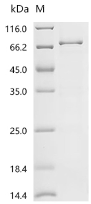Recombinant Prunus persica non-specific serine/threonine protein kinase (CSB-EP5511EZKd7)