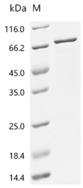 Recombinant Human Roundabout homolog 4 (ROBO4), partial (CSB-EP845177HU1d7)