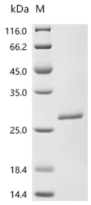 Recombinant Human Ribosomal protein eL39-like 2 (RPL39L) (CSB-EP850285HU)