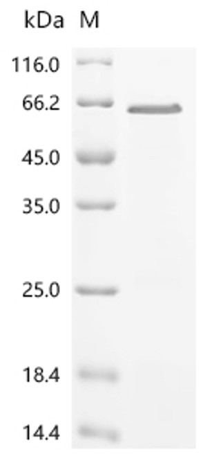 Recombinant Mouse Myristoylated alanine-rich C-kinase substrate (Marcks) (CSB-EP013493MO)